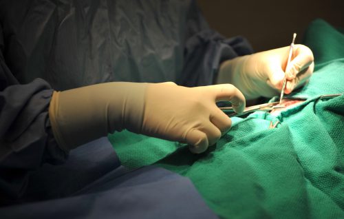 Suturing an incision after surgery Suturing an incision after surgery