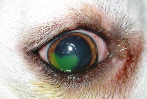 Refractory corneal ulcer