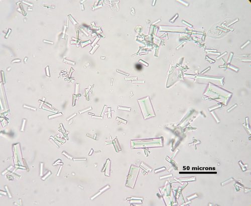 Struvite crystals from a dog