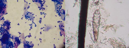 Microscope slides: Left Side: Yeast; Right Side: Demodex
